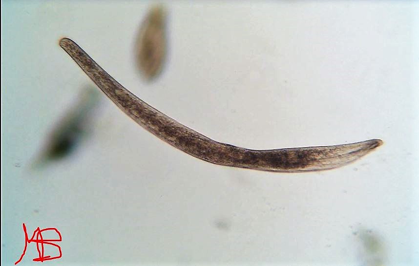 Spirostomum sp.
